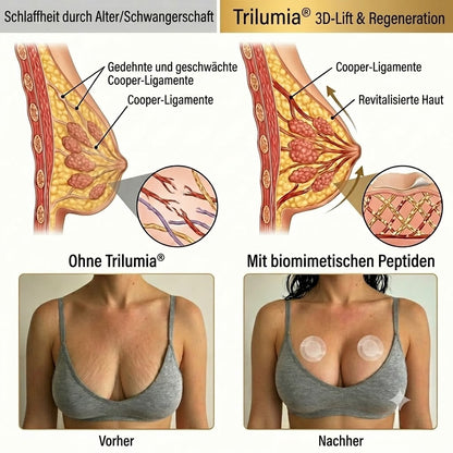 Trilumia® ✨Advanced Nano-Microneedle-Patch für mehr Brustvolumen & Straffung 🔴