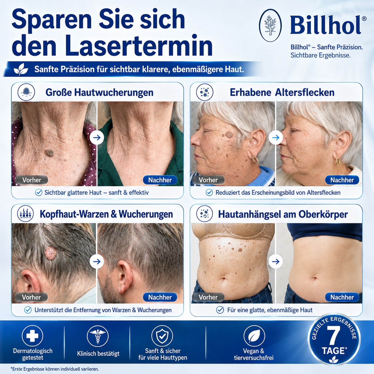 Billhol® Premium-Rollerball für ebenmäßige Haut🔴2