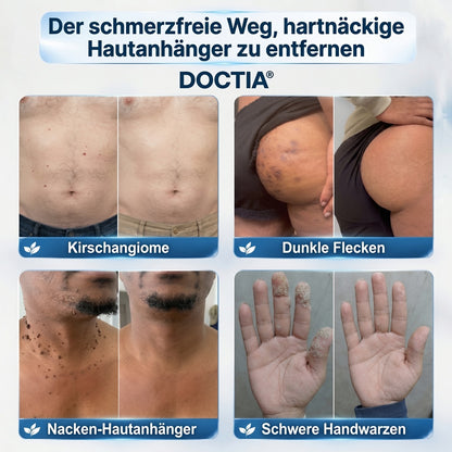 DOCTIA® Premium-Rollerball für ebenmäßige Haut🔴